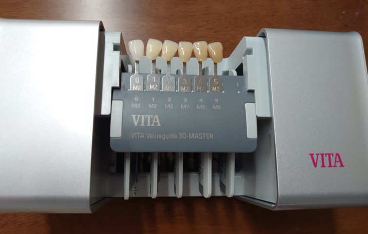 歯科医療 歯科技工 ビタ イージーシェードV デジタルシェード自動測定